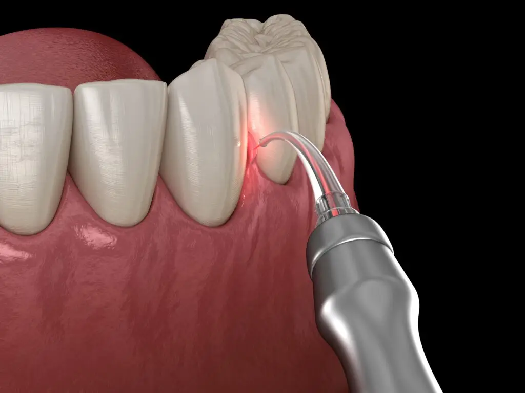 Laserterapia com a Dra. Mariela Baltazar no Tatuapé e Mooca